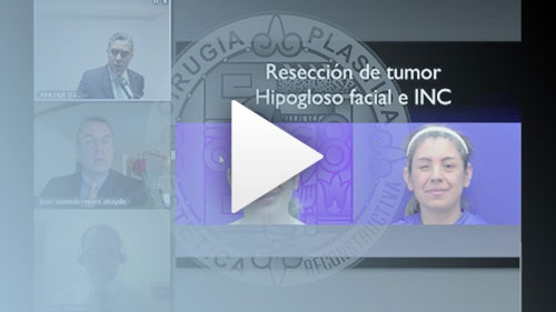 Video del Dr. Alexander Cárdenas Cirugía Plástica